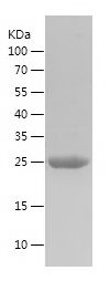    FUCA1 / Recombinant Human FUCA1