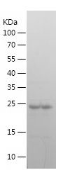    GATA3 / Recombinant Human GATA3