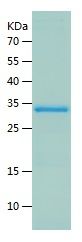    HNRNPA2B1 / Recombinant Human HNRNPA2B1