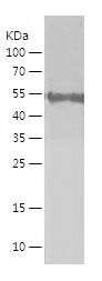    MAGEA4 / Recombinant Human MAGEA4