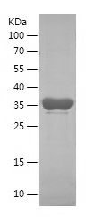    IGF2BP3 / Recombinant Human IGF2BP3