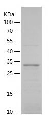    TMEM176B / Recombinant Human TMEM176B