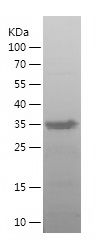    CD43 / Recombinant Human CD43