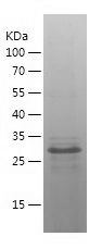    CDX2 / Recombinant Human CDX2