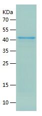    MAGEA3 / Recombinant Human MAGEA3