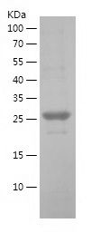    EEF1B2 / Recombinant Human EEF1B2