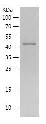    PROX1 / Recombinant Human PROX1