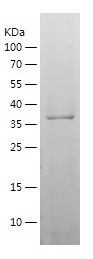    OVCA1 / Recombinant Human OVCA1