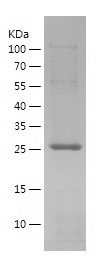    RAB9A / Recombinant Human RAB9A