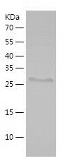    AMACR / Recombinant Human AMACR