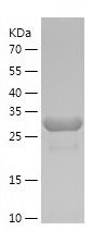    PSME3 / Recombinant Human PSME3