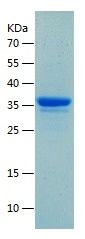    NY-ESO-1 / Recombinant Human NY-ESO-1