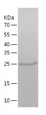    MYCN / Recombinant Human MYCN