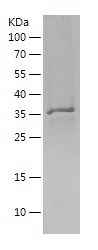    RPS27 / Recombinant Human RPS27