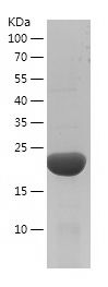    RKIP / Recombinant Human RKIP