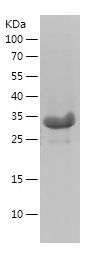    RCAS1 / Recombinant Human RCAS1