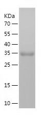    S100A3 / Recombinant Human S100A3