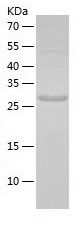    S100A1 / Recombinant Human S100A1