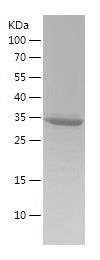    S100A5 / Recombinant Human S100A5