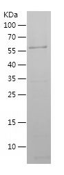    AnnexinV / Recombinant Human AnnexinV