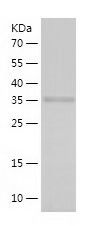    ROCK2 / Recombinant Human ROCK2