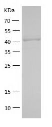    SALL4 / Recombinant Human SALL4