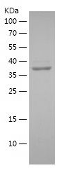    MYH10 / Recombinant Human MYH10