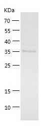    ROCK1 / Recombinant Human ROCK1