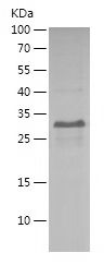    RNF4 / Recombinant Human RNF4