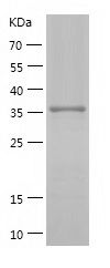    SHC / Recombinant Human SHC