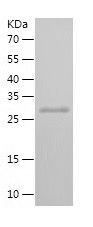    SMAD4 / Recombinant Human SMAD4