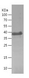    ELK1 / Recombinant Human ELK1