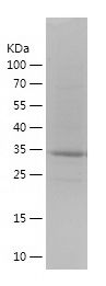    S100A11 / Recombinant Human S100A11