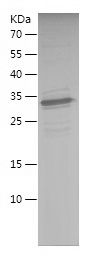    SMAD1 / Recombinant Human SMAD1