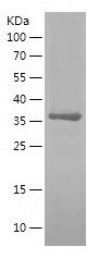    RAD51 / Recombinant Human RAD51