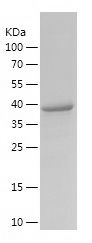    PINX1 / Recombinant Human PINX1