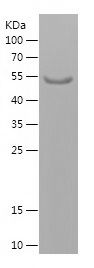    TACC2 / Recombinant Human TACC2