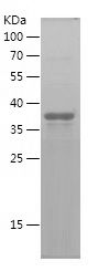    SFRP2 / Recombinant Human SFRP2