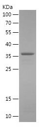   ST5 / Recombinant Human ST5