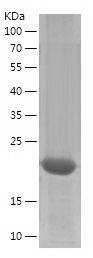    PTGDS / Recombinant Human PTGDS