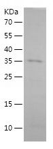    SST / Recombinant Human SST