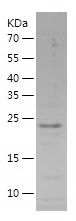    SSX5 / Recombinant Human SSX5