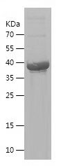    SMAD3 / Recombinant Human SMAD3