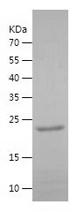    IRAK3 / Recombinant Human IRAK3