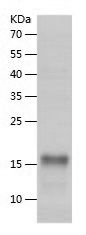    HER2 / Recombinant Human HER2