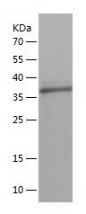    SHH / Recombinant Human SHH