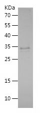    PSCA / Recombinant Human PSCA