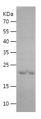 Recombinant rat A1AG