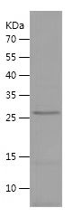    NEFL / Recombinant Human NEFL