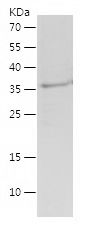    SMAD9 / Recombinant Human SMAD9